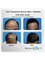 Rejuvenate Hair Transplant Centre - Hair Transplant Result After 7 Months -FUE Hair Transplant 