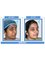 ALCS-Hair Transplant & Cosmetic Clinic - K-58, behind Dana Pani Restaurant, Kishan Nagar, Shyam Nagar, Jaipur, Rajasthan, 302019,  2