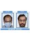 ALCS-Hair Transplant & Cosmetic Clinic - K-58, behind Dana Pani Restaurant, Kishan Nagar, Shyam Nagar, Jaipur, Rajasthan, 302019,  30