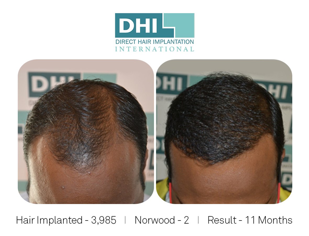 Oliva Skin & Hair Clinic Kadavanthra - Kochi, India