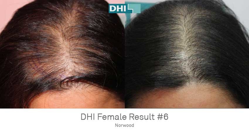 Oliva Skin & Hair Clinic Kadavanthra - Kochi