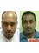 Hair Science kolhapur - 169 E-ward,Opposite State Bank of Patiyala,Tarabai Park, Kolhapur, Maharashtra, 416003,  3