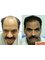 Hair Science kolhapur - 169 E-ward,Opposite State Bank of Patiyala,Tarabai Park, Kolhapur, Maharashtra, 416003,  4