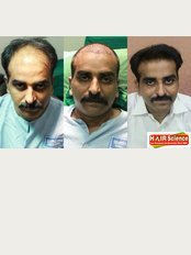 Hair Science kolhapur - 169 E-ward,Opposite State Bank of Patiyala,Tarabai Park, Kolhapur, Maharashtra, 416003, 