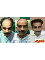 Hair Science kolhapur - 169 E-ward,Opposite State Bank of Patiyala,Tarabai Park, Kolhapur, Maharashtra, 416003,  0