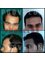 Provelus Hair Transplant Clinic - 1001, Padma Tower-1, Rajendra Place, Pusa Road, New Delhi, Delhi, 110008,  4