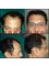 Provelus Hair Transplant Clinic - 1001, Padma Tower-1, Rajendra Place, Pusa Road, New Delhi, Delhi, 110008,  5