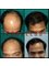 Provelus Hair Transplant Clinic - 1001, Padma Tower-1, Rajendra Place, Pusa Road, New Delhi, Delhi, 110008,  9