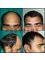 Provelus Hair Transplant Clinic - 1001, Padma Tower-1, Rajendra Place, Pusa Road, New Delhi, Delhi, 110008,  7