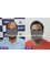 TRICHOS Hair Transplant Institute - Plot no 72,1st Floor,, Above Vision Express, Opp AS Rao nagar Khaman, Hyderabad, Hyderabad, Telangana, 500062,  8