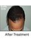 Radiance Hair Transplant Vijayawada - Gayatri Nagar,Near Benz circle, Vijayawada, Andhra Pradesh, 520008,  1