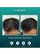 HairDoc Medical Publika - A2-1-05, Solaris Dutamas, No 1, Jalan Dutamas 1, Malaysia, 50480,  3