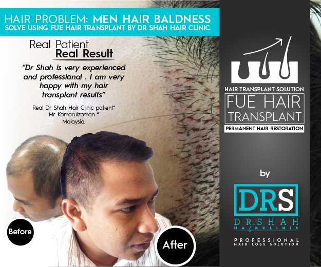 Dr Shah Hair Clinic in Subang Jaya, Malaysia • Read 4 Reviews