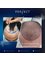 Perfect Hair - 10 Days after the hair transplantation 
