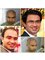 HairAge - Art in Hair Restoration - 38-A, Happy Homes, Main Gulberg, Lahore,  3