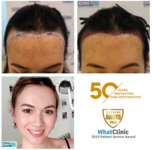 DHI Philippines by Clinique de Paris in Makati City • Read 23 Reviews