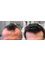 Cheveux Hair Transplant Center - Plac Strzelecki 24, Wroclaw, 50500,  2