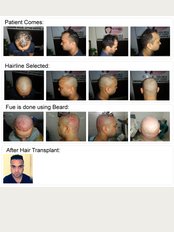 Satyam Hair Transplant Russia - Street-Rodionova 165/9,Flat-30, Nizhney Novgorod, Volga Federal District, 603000, 
