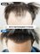 Dream Hairline Hair Transplant - 567-23 Sinsa-dong, Gangnam-gu, Seoul,  19