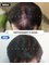 Dream Hairline Hair Transplant - 567-23 Sinsa-dong, Gangnam-gu, Seoul,  24