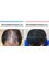 Dream Hairline Hair Transplant - 567-23 Sinsa-dong, Gangnam-gu, Seoul,  11