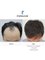FORHAIR Hair Transplant Korea - 2F, A857 Building, 857 Nonhyeon-ro, Seoul, Korea,  4