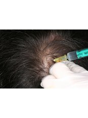 Hair Loss Specialist Consultation - Institut Pelo Vila-Rovira Clinica Transplante de Pelo