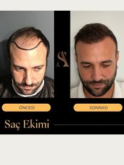 Dr. Ali Şahan Hairclinic - Aziziye, Cinnah Caddesi No:112, Çankaya, ANKARA, TURKEY, 
