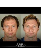 Hair Loss Specialist Consultation - APERA Hair