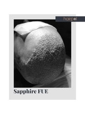 Sapphire FUE Hair Transplant by ISHRS DR.MURAT KONAKCI - Hairpol Hair Clinic