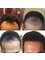 Hair Transplants Istanbul - Dikilitas Mahallesi, Omur Sokak No:4, Istanbul, Besiktas, 34349,  4