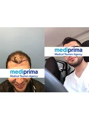 Haartransplantation - Mediprima