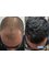 Medlife Group - Hair Transplant - Kusadasi - 19 Mayıs Caddesi Dr. Hüsnü İsmet Öztürk Sokak, Şişli Plaza, Kusadasi, Istanbul, 09400,  3
