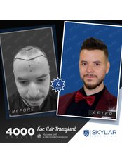 Hair Loss Specialist Consultation - Skylar Health