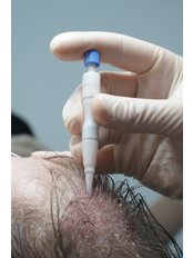 DHI - Direct Hair Implantation with Global Experience and ISHRS Doctor - Doctor Bircan