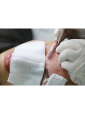 Eyebrow Transplant with Global Experience and ISHRS Doctor - Doctor Bircan
