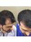 Dr Cinik Hair Transplant Clinic - 5 times treatment with 1000mg biotin suppliment  