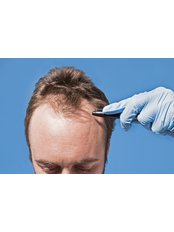 DHI - Direct Hair Implantation - Medicaleste
