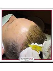 Hair Loss Treatment - Metropol Med Hair Transplant