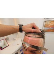 Hair Loss Specialist Consultation - OPAL Clinic - Kalamis - Hair Transplant