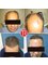 Transes Hair Transplant - Halkalı Merkez Mh. Dereboyu Cd. No:4 Kat:3 D:24 Antplato, Küçükçekmece, Istanbul, 34303,  13