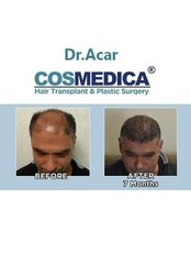 Cosmedica Dr.Acar HairTransplant & Esthetics - Etiler, Nisbetiye Mah, Başlık Sk. No: 3, Beşiktaş, Istanbul, 34337,  0