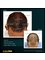 Essi Hair Transplant Clinic - Cumhuriyet Bulvarı No:161, Martı Apartmanı Alsancak, Konak İZMİR, İZMİR, TURKEY, 35220,  21