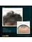 Essi Hair Transplant Clinic - Cumhuriyet Bulvarı No:161, Martı Apartmanı Alsancak, Konak İZMİR, İZMİR, TURKEY, 35220,  14