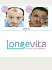 Longevita Hair Transplant - Izmir - Cemal Gursel Caddesi No: 248, Daire: 2 Karsiyaka, Izmir, www.longevita.co.uk, 