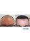Medlife Group - Hair Transplant - Izmir - Akdeniz, Mah. Cumhuriyet Blv. No:111/501 Konak, Konak, Izmir, 35210,  4
