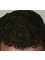 Aberdeen Hair Restoration Clinic - 13 Correction Wynd, Aberdeen, AB101HP,  3
