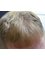Aberdeen Hair Restoration Clinic - 13 Correction Wynd, Aberdeen, AB101HP,  2