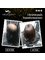 UltraStrands Hair Volumising Systems - Female pattern baldness before and after  
