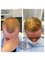 The Hair Loss Clinic - Exeter - 1 Barnfield Crescent, Exeter, EX1 1QT,  9